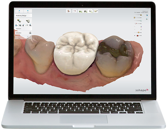 Dental Design Software