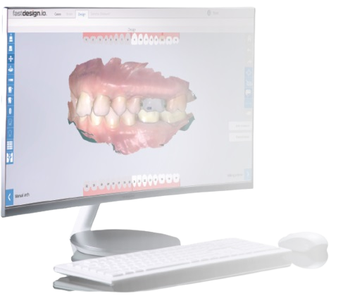 fastdesign.io dental software