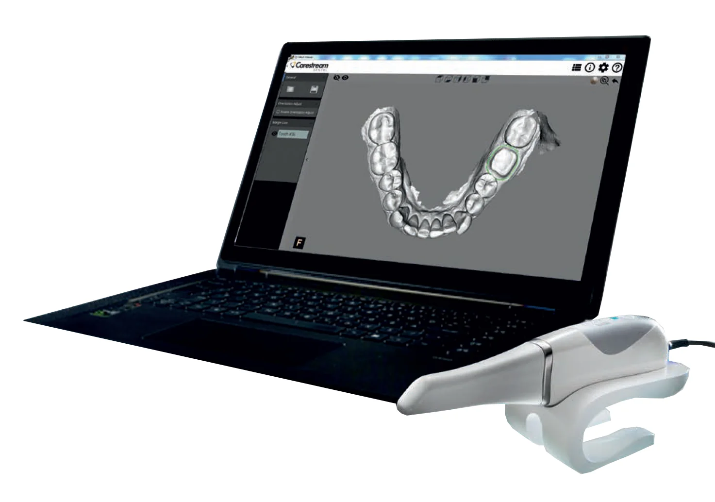 Carestream CS 3600 intraoral scanner with laptop